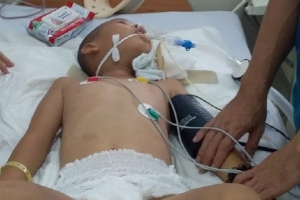 Kiên Giang: Trèo cây hái quả, bé trai 12 tuổi bị ngã dập tủy sống