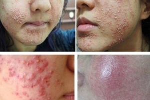 Hiểm họa từ mỹ phẩm giả - Bài 2: Mỹ phẩm DỎM bủa vây - người tiêu dùng khó tránh