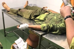 Một kiểm lâm viên Vườn Quốc gia Yok Đôn bị chém đứt gân tay
