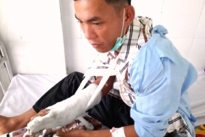 Kon Tum: Nhân viên bảo vệ rừng bị chém trọng thương vì không cho xe độ chế vào rừng