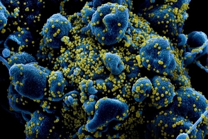 Sản xuất thành công kháng thể đơn dòng tiêu diệt được virus corona