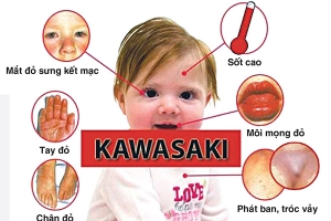 Cảnh báo bệnh Covid-19: 2 biến chứng nguy hiểm ở trẻ em