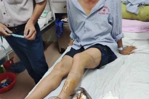 Hà Tĩnh: Sẽ xử lý nghiêm 3 cha con hành hung, chém đứt gân chân công an xã