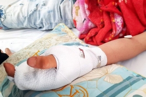 Bé trai 9 tuổi dập bàn tay vì chơi điện thoại đang sạc pin