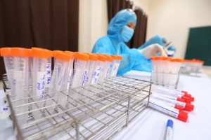 Một nhân viên y tế ở Hải Phòng dương tính với SARS-CoV-2