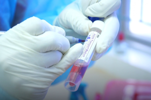 Chưa có bằng chứng người đàn ông ở Bạc Liêu nhiễm SARS-CoV-2