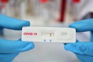Bộ Y tế yêu cầu các cơ sở sản xuất, NK báo cáo giá bán test xét nghiệm Covid-19