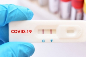 Đồng Nai: Yêu cầu các đơn vị không thu phí xét nghiệm test nhanh Covid-19 của bệnh nhân