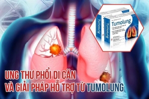 Thông tin về ung thư phổi di căn và giải pháp hỗ trợ từ Tumolung