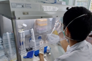 TP. HCM yêu cầu các đơn vị báo cáo việc mua kit test của Công ty Việt Á
