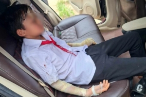 Nổ bóng bay trong ngày khai giảng, 7 học sinh phải nhập viện