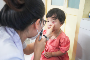 Bộ Y tế yêu cầu giám sát và không để thiếu thuốc bệnh đau mắt đỏ