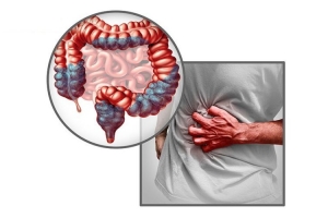 Viêm đại tràng co thắt: Nguyên nhân và giải pháp từ Đại tràng Á Âu