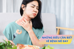 Những điều cần biết về nổi mề đay và giải pháp từ Phụ Bì Khang