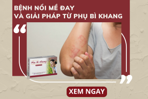 Bệnh nổi mề đay và giải pháp từ Phụ Bì Khang