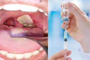 Quảng Bình: Tăng cường công tác phòng, chống bệnh bạch hầu
