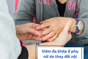Nguyên nhân gây bệnh viêm đa khớp ở phụ nữ và cách cải thiện từ Hoàng Thấp Linh