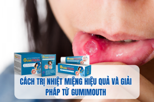 Cách trị nhiệt miệng hiệu quả và giải pháp từ Gumimouth