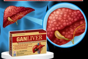 Men gan cao có nguy hiểm không và giải pháp từ Ganliver
