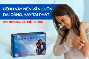 Bệnh vảy nến đeo bám dai dẳng, hay tái phát - Hãy dùng ngay Kim Miễn Khang!