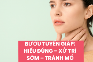 Bướu tuyến giáp: Hiểu đúng – Xử trí sớm – Tránh mổ không cần thiết