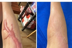 Nhiều khách hàng bức xúc Viện thẩm mỹ Emprie Lạng Sơn (Viện sắc đẹp Emprie)