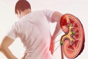 5 dấu hiệu bất thường ở tay phản ánh thận đang suy yếu
