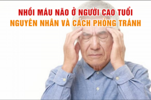Nhồi máu não ở người cao tuổi: Nguyên nhân và cách phòng tránh