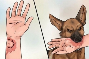Cả nước ghi nhận 50 ca tử vong do bệnh dại, Hà Nội thí điểm phòng chống dại