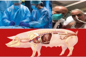Y học đột phá: Cấy ghép phổi lợn thành công
