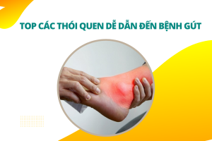 Top các thói quen dễ dẫn đến bệnh gút và cách phòng ngừa hiệu quả