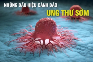 10 Dấu hiệu cảnh báo ung thư nam giới cần biết: Tầm soát và nhận diện sớm để chiến thắng bệnh tật