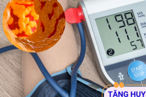 Làm thế nào để cải thiện tăng huyết áp kèm mỡ máu cao?