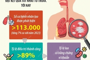 Thành công của Việt Nam trong điều trị lao: Tỷ lệ chữa khỏi 90%, nỗ lực chấm dứt bệnh vào 2030
