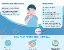 Cúm A: Nhận biết dấu hiệu và cách điều trị kịp thời để tránh biến chứng nguy hiểm