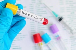 Virus Marburg cực kỳ nguy hiểm, gây chết người bùng phát tại Ethiopia