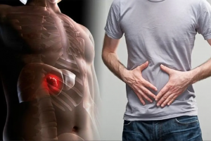 Bệnh u bướu - Nguyên nhân và cách chủ động phòng ngừa hiệu quả