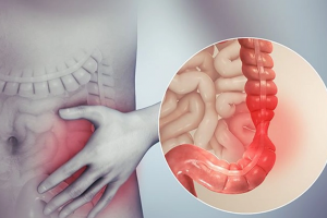 6 cách giúp cải thiện đại tràng co thắt hiệu quả, giảm tái phát
