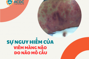 Bệnh não mô cầu gia tăng đột biến, cảnh báo về nguy cơ tử vong trong 24 giờ
