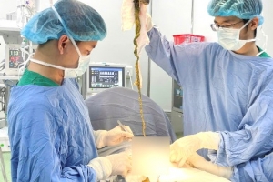 Bệnh viện Phụ sản - Nhi Đà Nẵng: Phẩu thuật một ca do trẻ em ăn tóc, hiếm gặp trong y khoa