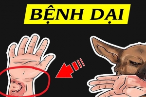 Hà Nội: Xuất hiện ổ dịch dại trên chó, cảnh báo mức độ nguy hiểm độ III từ các vết cắn