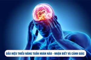 Dấu hiệu thiểu năng tuần hoàn não - Nhận biết và cảnh giác