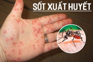 Hà Tĩnh ghi nhận ổ dịch sốt xuất huyết đầu tiên trong năm