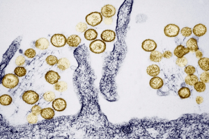 Virus Hanta khiến 3 người tử vong, Bộ Y tế phát cảnh báo khẩn
