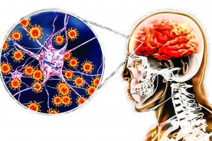 Ghi nhận một ca tử vong do viêm não Nhật Bản tại Thanh Hóa