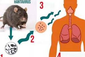 Hantavirus không có khả năng lây lan thành đại dịch dù tỷ lệ tử vong cao