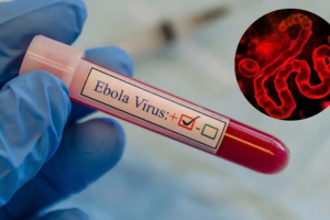 Ebola lây lan nhanh, tử vong tới 90%, Bộ Y tế yêu cầu tăng cường giám sát
