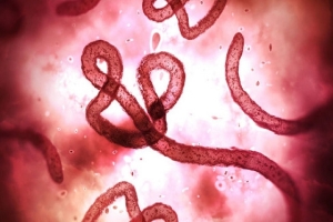 Ngành Y tế Lâm Đồng chủ động kích hoạt các biện pháp phòng, chống dịch Ebola