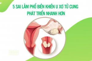 5 sai lầm phổ biến khiến u xơ tử cung phát triển nhanh hơn