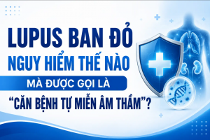 Lupus ban đỏ – Căn bệnh tự miễn nguy hiểm hơn nhiều người nghĩ